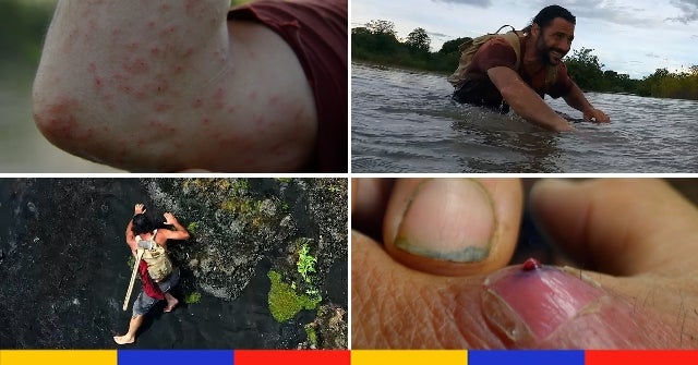 Larve dans la main, attaque de guêpes, insectes piqueurs : Hazen Audel raconte les 5 trucs les plus fous vécus dans la forêt amazonienne